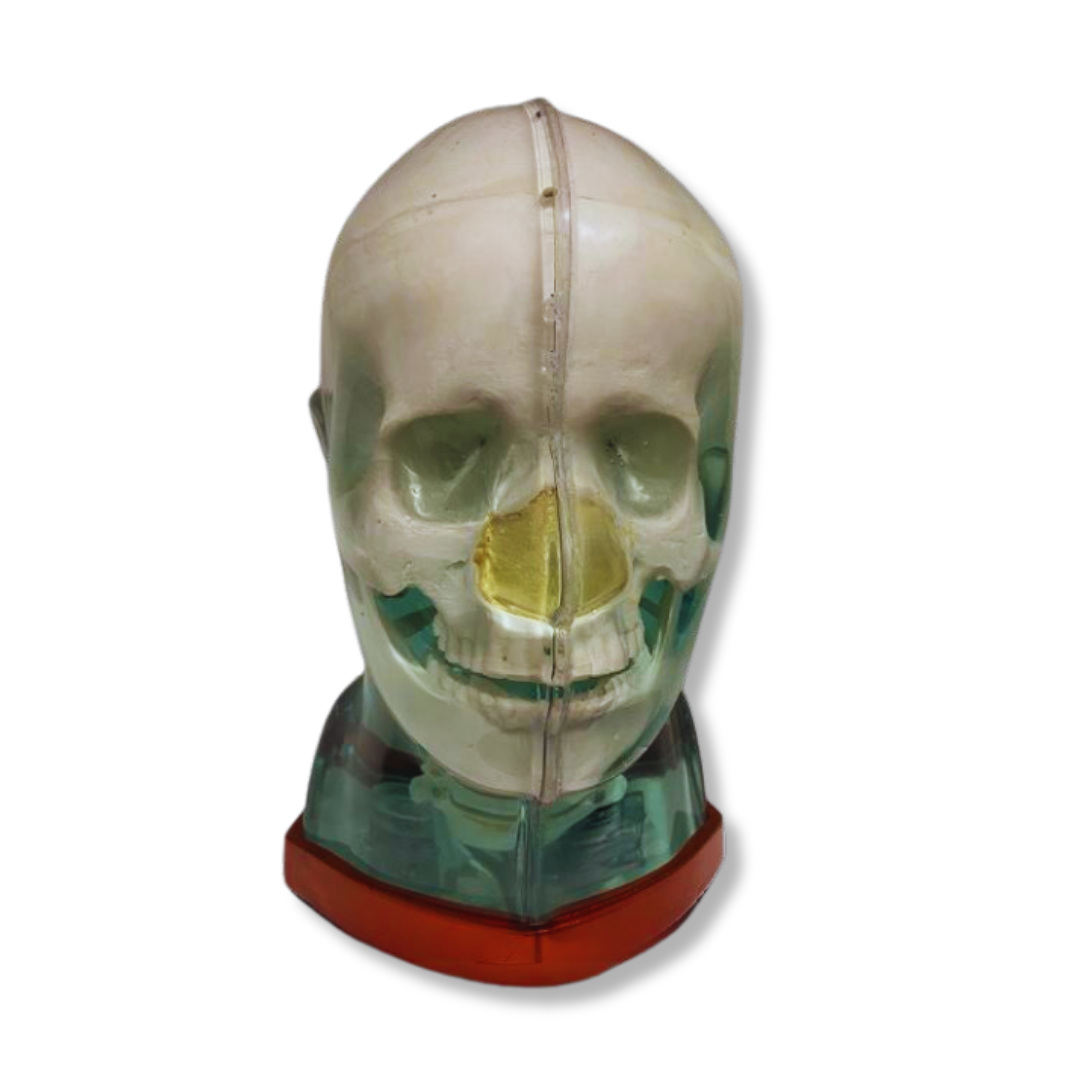 RSD Multi-Modality Fusion Head Phantom, shown for multi-modality