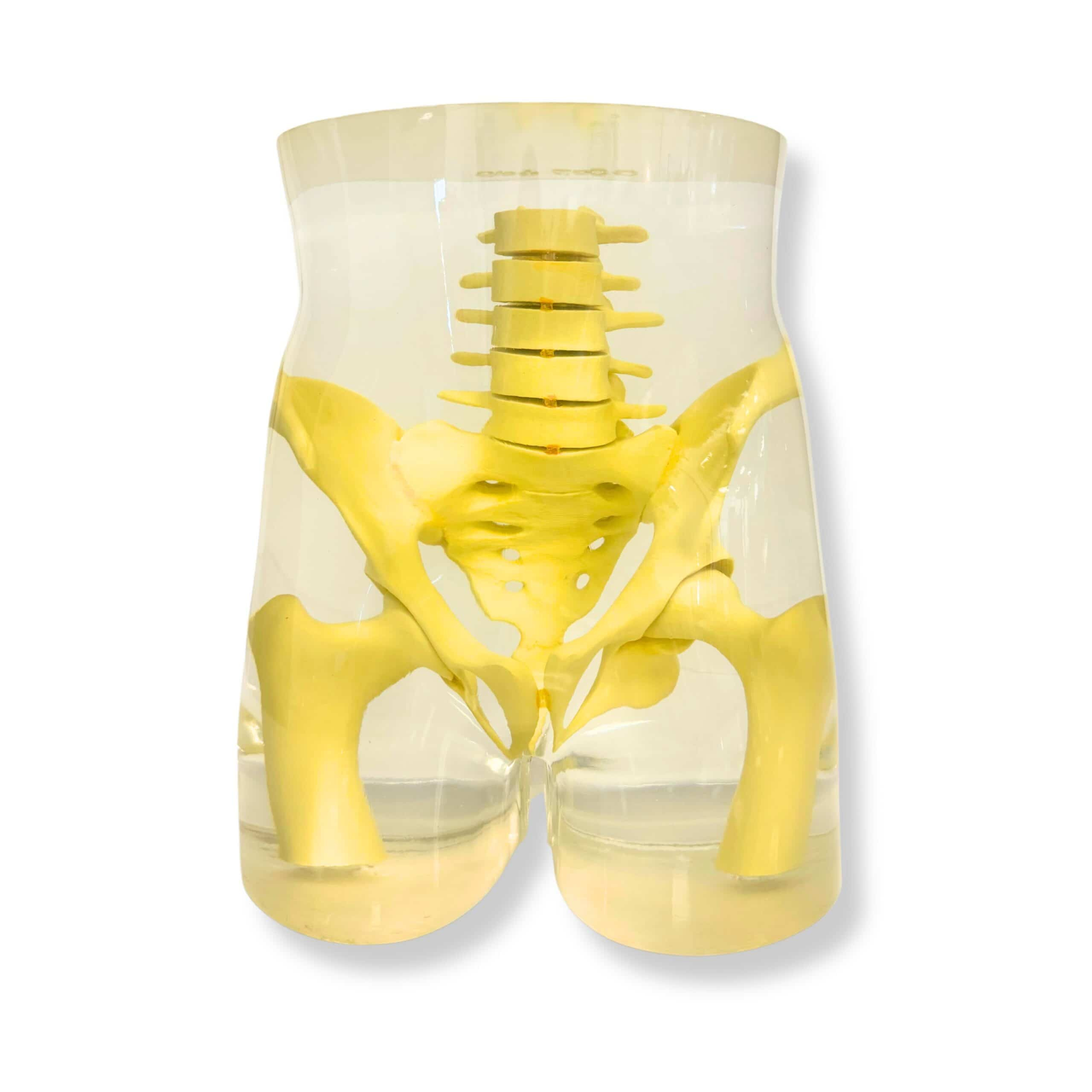 RSD Pelvis Phantom, shown for medical imaging